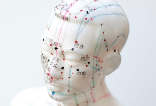 Could Acupuncture Boost Your Wellbeing?