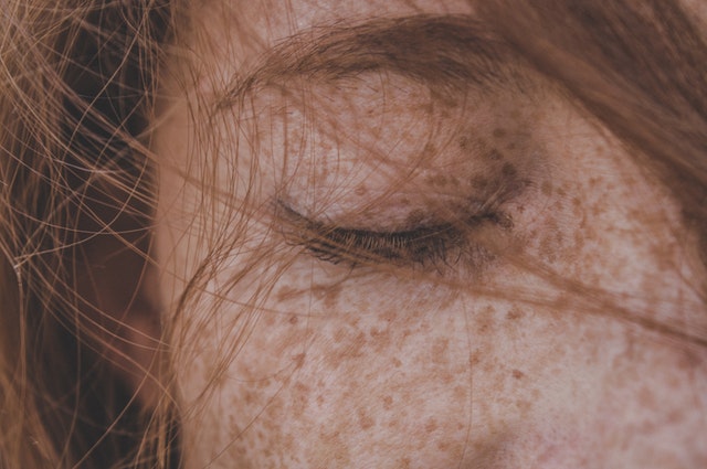 Why Your Skin & Mental Health Are So Connected