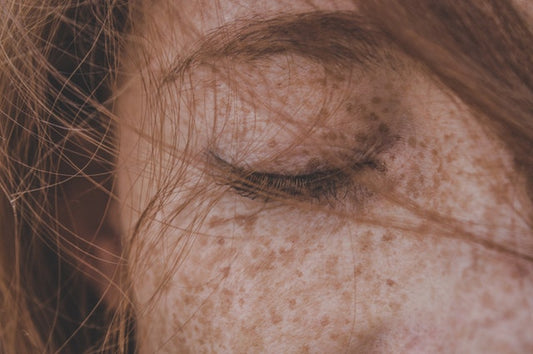 Why Your Skin & Mental Health Are So Connected